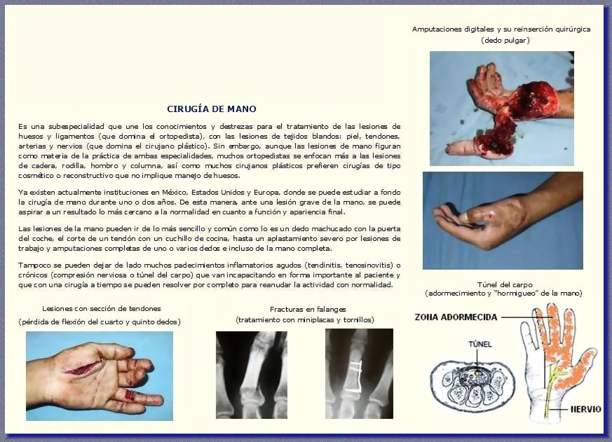 cmp110720005003.jpg
